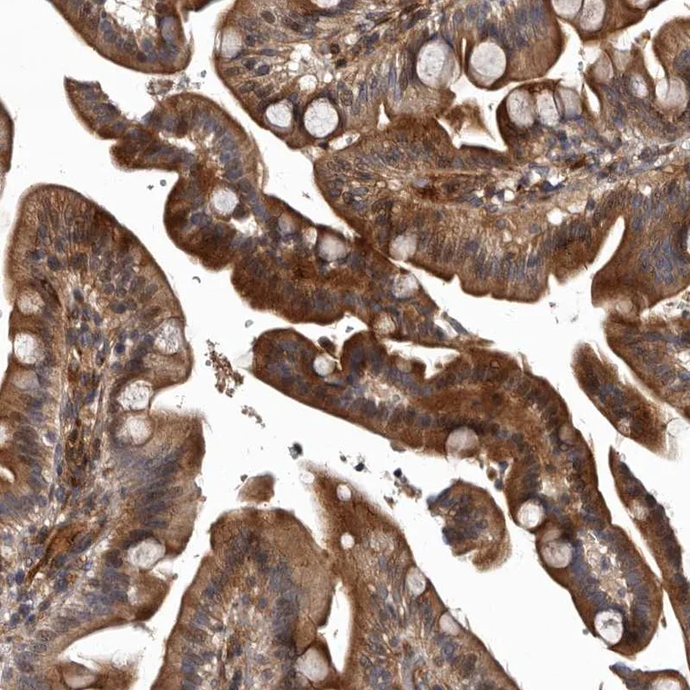 Immunohistochemistry (Formalin/PFA-fixed paraffin-embedded sections) - Anti-PKC nu/PRKD3 antibody (AB252982)
