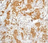 Immunohistochemistry (Formalin/PFA-fixed paraffin-embedded sections) - Anti-PKC (phospho S660) antibody [EP1902Y] (AB75837)