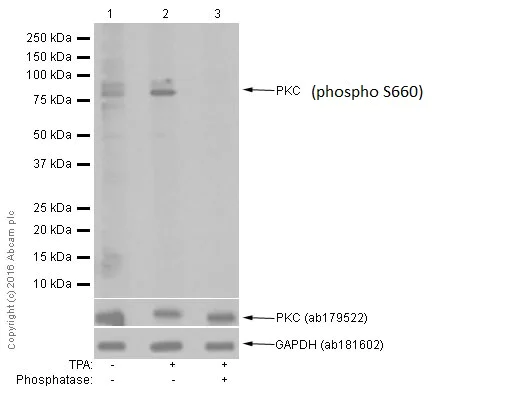 Western blot - Anti-PKC (phospho S660) antibody [EP1902Y] (AB75837)
