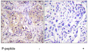 Immunohistochemistry (Formalin/PFA-fixed paraffin-embedded sections) - Anti-PKC (phospho T497) antibody (AB59411)