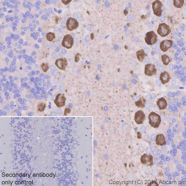 Immunohistochemistry (Formalin/PFA-fixed paraffin-embedded sections) - Anti-PKC (phospho T514) antibody [EP2730Y] (AB109539)