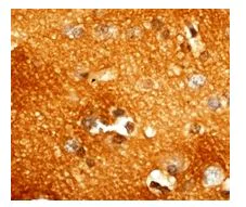 Immunohistochemistry (Formalin/PFA-fixed paraffin-embedded sections) - Anti-PKC (phospho T514) antibody [EP2730Y] (AB109539)