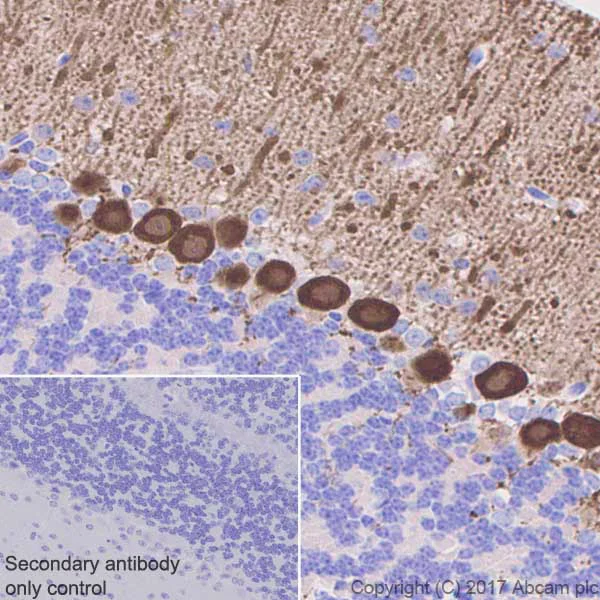 Immunohistochemistry (Formalin/PFA-fixed paraffin-embedded sections) - Anti-PKC (phospho T514) antibody [EP2730Y] (AB109539)