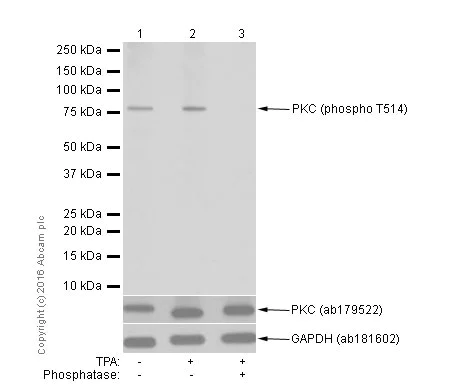 Western blot - Anti-PKC (phospho T514) antibody [EP2730Y] (AB109539)