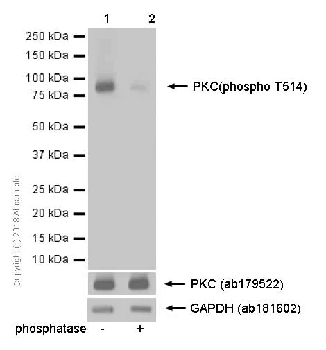 Western blot - Anti-PKC (phospho T514) antibody [EP2730Y] (AB109539)