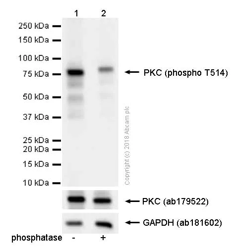 Western blot - Anti-PKC (phospho T514) antibody [EP2730Y] (AB109539)
