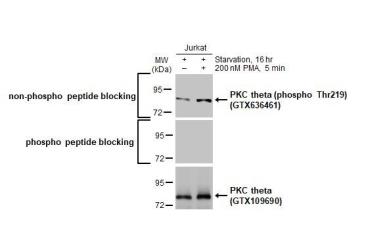 Western blot - Anti-PKC theta phospho Thr219 antibody [HL1157] (AB308345), expandable thumbnail