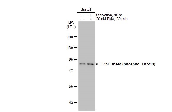 Western blot - Anti-PKC theta phospho Thr219 antibody [HL1157] (AB308345), expandable thumbnail