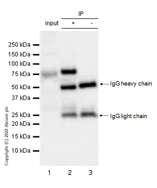 Immunoprecipitation - Anti-PKC theta/PRKCQ antibody [27/PKC theta] (AB302891), expandable thumbnail