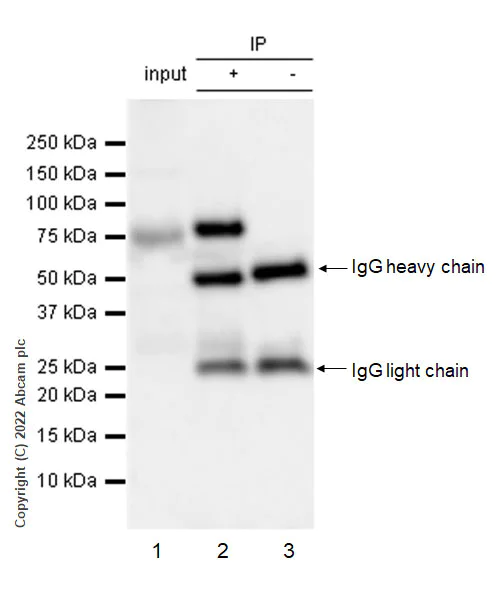 Immunoprecipitation - Anti-PKC theta/PRKCQ antibody [27/PKC theta] (AB302891)