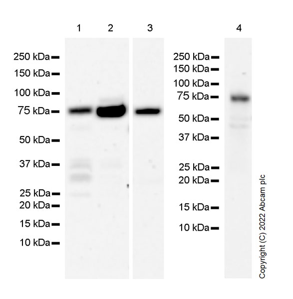 Western blot - Anti-PKC theta/PRKCQ antibody [27/PKC theta] (AB302891), expandable thumbnail