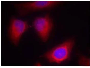 Immunocytochemistry/ Immunofluorescence - Anti-PKC theta/PRKCQ antibody (AB131503)