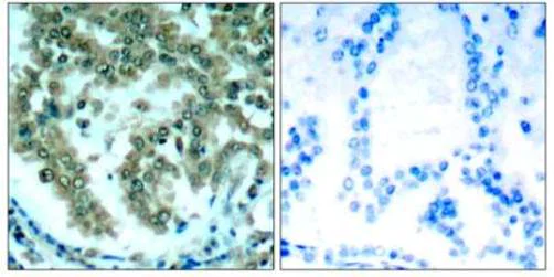 Immunohistochemistry (Formalin/PFA-fixed paraffin-embedded sections) - Anti-PKC theta/PRKCQ antibody (AB131503)