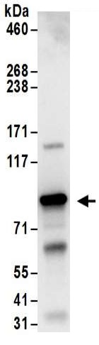 Immunoprecipitation - Anti-PKC theta/PRKCQ antibody (AB185974)