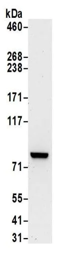 Western blot - Anti-PKC theta/PRKCQ antibody (AB185974)