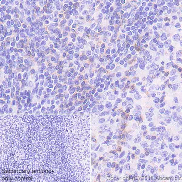 Immunohistochemistry (Formalin/PFA-fixed paraffin-embedded sections) - Anti-PKC theta/PRKCQ antibody [EPR22277] (AB230971)