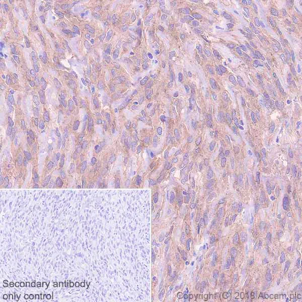 Immunohistochemistry (Formalin/PFA-fixed paraffin-embedded sections) - Anti-PKC theta/PRKCQ antibody [EPR22277] (AB230971)