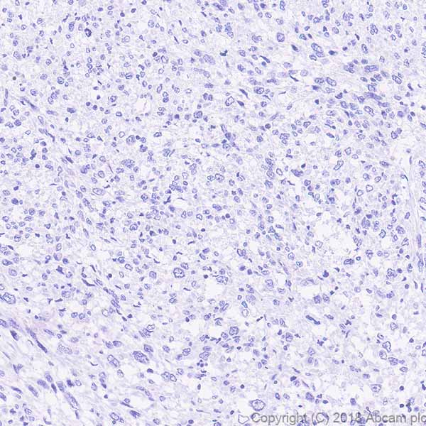Immunohistochemistry (Formalin/PFA-fixed paraffin-embedded sections) - Anti-PKC theta/PRKCQ antibody [EPR22277] (AB230971)