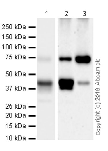 Western blot - Anti-PKC theta/PRKCQ antibody [EPR22277] (AB230971)