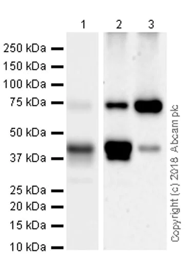 Western blot - Anti-PKC theta/PRKCQ antibody [EPR22277] (AB230971)