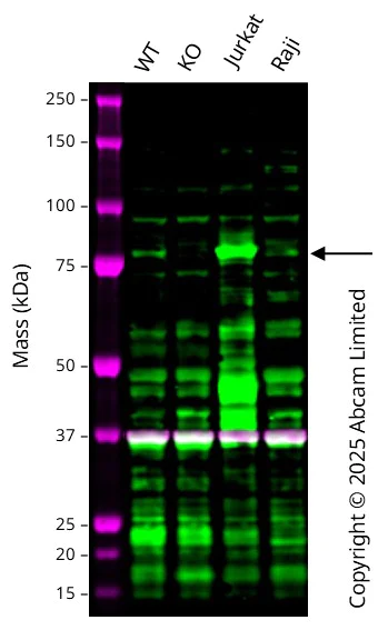Western blot - Anti-PKC theta/PRKCQ antibody [EPR22277] - BSA and Azide free (AB243851)