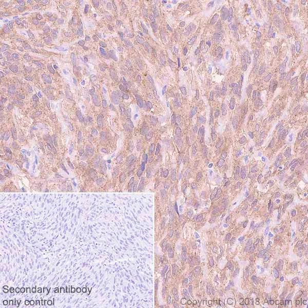 Immunohistochemistry (Formalin/PFA-fixed paraffin-embedded sections) - Anti-PKC theta/PRKCQ antibody [EPR22281] (AB230972)