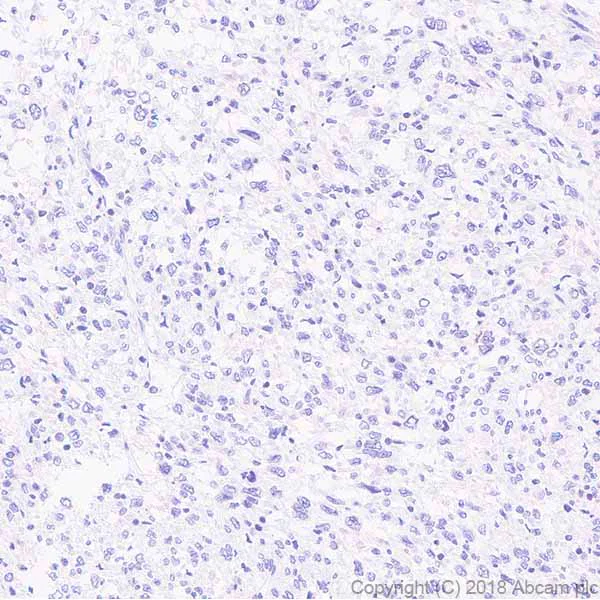 Immunohistochemistry (Formalin/PFA-fixed paraffin-embedded sections) - Anti-PKC theta/PRKCQ antibody [EPR22281] (AB230972)