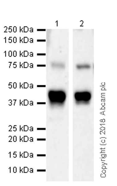 Western blot - Anti-PKC theta/PRKCQ antibody [EPR22281] (AB230972)