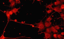 Immunocytochemistry/ Immunofluorescence - Anti-PKC theta/PRKCQ antibody [M217] (AB76197)