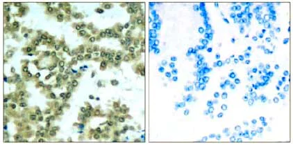 Immunohistochemistry (Formalin/PFA-fixed paraffin-embedded sections) - Anti-PKC theta/PRKCQ (phospho S676) antibody (AB131479)
