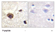 Immunohistochemistry (Formalin/PFA-fixed paraffin-embedded sections) - Anti-PKC theta/PRKCQ (phospho T538) antibody (AB63365), expandable thumbnail