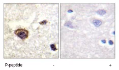Immunohistochemistry (Formalin/PFA-fixed paraffin-embedded sections) - Anti-PKC theta/PRKCQ (phospho T538) antibody (AB63365)