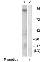 Western blot - Anti-PKC theta/PRKCQ (phospho T538) antibody (AB63365), expandable thumbnail