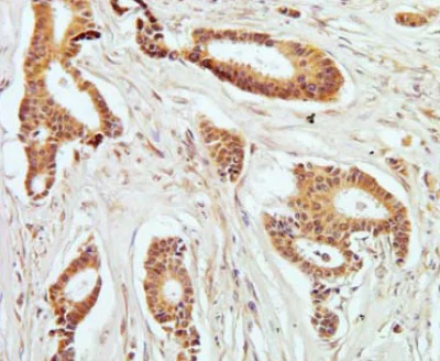 Immunohistochemistry (Formalin/PFA-fixed paraffin-embedded sections) - Anti-PKC theta/PRKCQ (phospho T538) antibody [F4H4L1] (AB203565)
