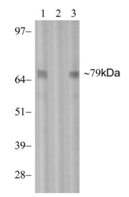 Western blot - Anti-PKC theta/PRKCQ (phospho T538) antibody [F4H4L1] (AB203565)