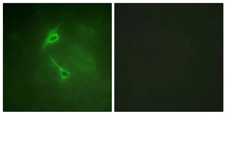 Immunocytochemistry/ Immunofluorescence - Anti-PKC zeta antibody (AB59364)