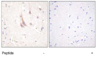 Immunohistochemistry (Formalin/PFA-fixed paraffin-embedded sections) - Anti-PKC zeta antibody (AB59364)