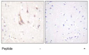 Immunohistochemistry (Formalin/PFA-fixed paraffin-embedded sections) - Anti-PKC zeta antibody (AB59364)