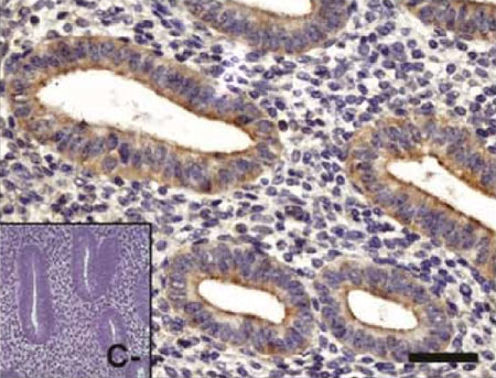 Anti-PKC zeta antibody