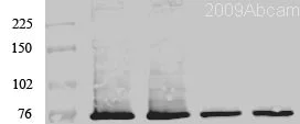 Western blot - Anti-PKC zeta antibody (AB59364)