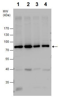 Western blot - Anti-PKC zeta antibody - C-terminal (AB226772)