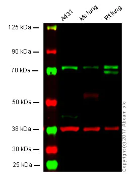 Western blot - Anti-PKC zeta antibody [EP1490(2)] (AB108970)