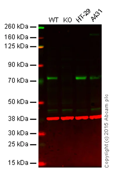 Western blot - Anti-PKC zeta antibody [EP1490(2)] - BSA and Azide free (AB225554)