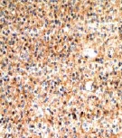 Immunohistochemistry (Formalin/PFA-fixed paraffin-embedded sections) - Anti-PKC zeta (phospho T410) + PKC iota (phospho T412) antibody [EP1491Y] (AB76129)