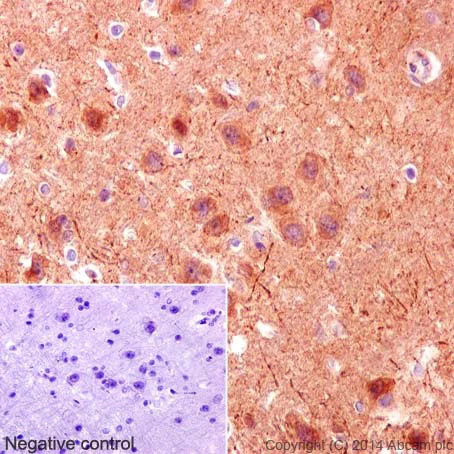 Immunohistochemistry (Formalin/PFA-fixed paraffin-embedded sections) - Anti-PKC zeta (phospho T410) + PKC iota (phospho T412) antibody [EP1491Y] (AB76129)