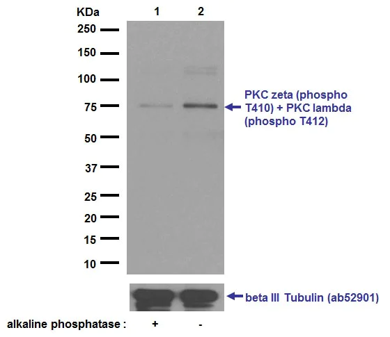 Western blot - Anti-PKC zeta (phospho T410) + PKC iota (phospho T412) antibody [EP1491Y] (AB76129)