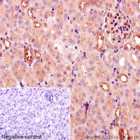 Immunohistochemistry (Formalin/PFA-fixed paraffin-embedded sections) - Anti-PKC zeta (phospho T410) + PKC iota (phospho T412) antibody [EP1491Y] - BSA and Azide free (AB247446)