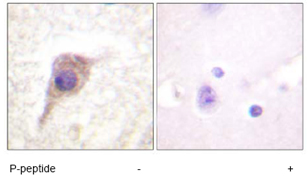 Immunohistochemistry (Formalin/PFA-fixed paraffin-embedded sections) - Anti-PKC zeta (phospho T560) antibody (AB59412)