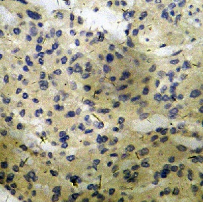 Immunohistochemistry (Formalin/PFA-fixed paraffin-embedded sections) - Anti-PKC zeta (phospho T560) antibody (AB59412)