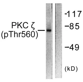 Western blot - Anti-PKC zeta (phospho T560) antibody (AB59412)
